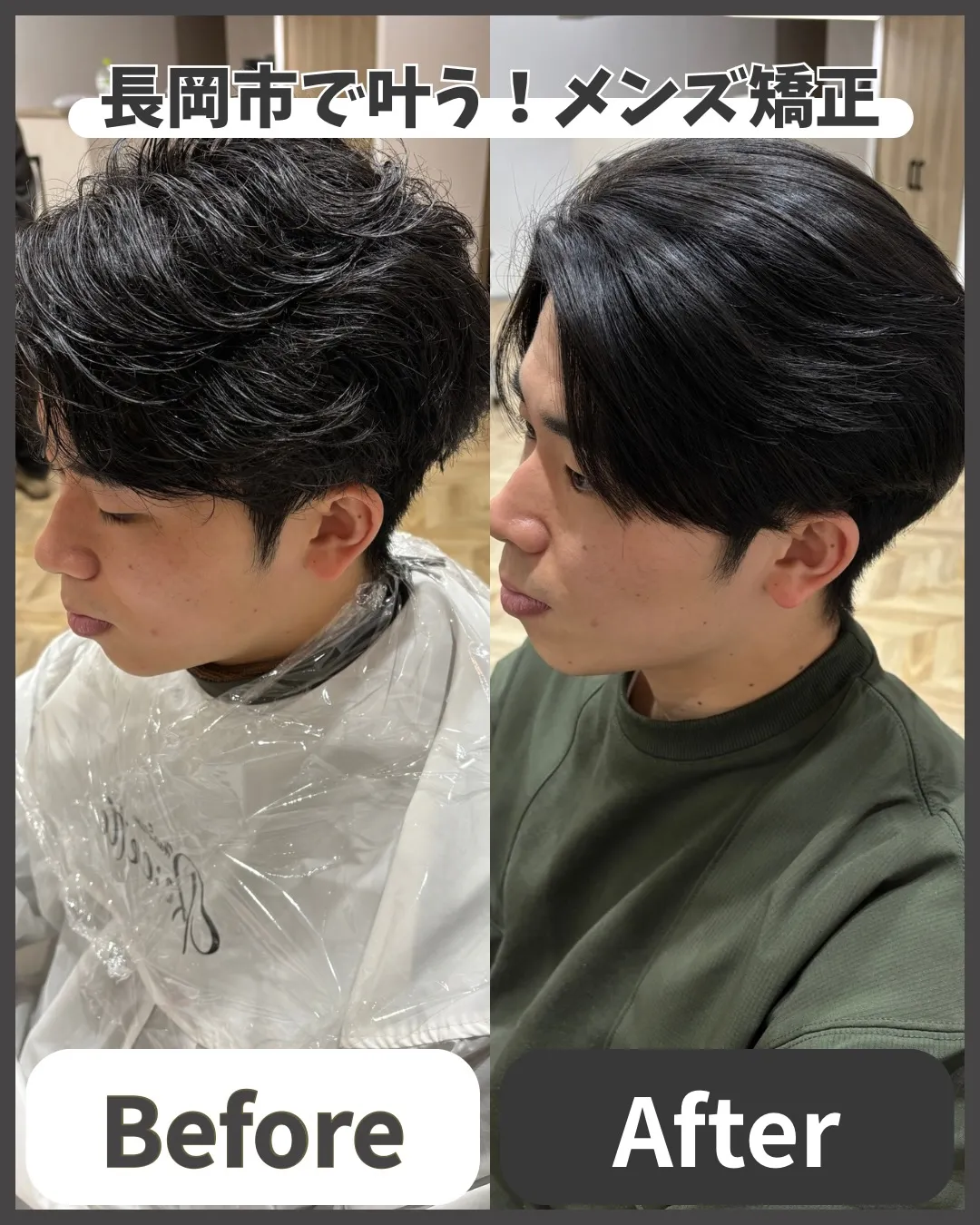 新潟県長岡市で叶えるメンズ矯正！